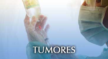 tumores cancer