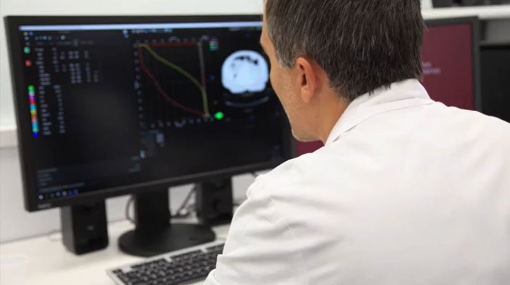 Cuánto dura una sesión de radioterapia