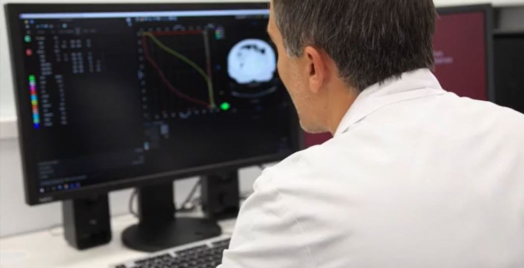 Cuánto dura una sesión de radioterapia